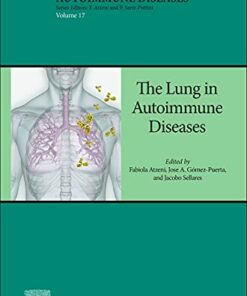 The Lung in Autoimmune Diseases (Volume 17) (Handbook of Systemic Autoimmune Diseases, Volume 17) (EPUB)