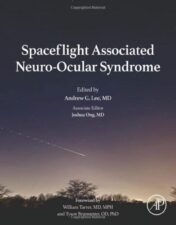 Spaceflight Associated Neuro-Ocular Syndrome 2022 Epub+ converted pdf