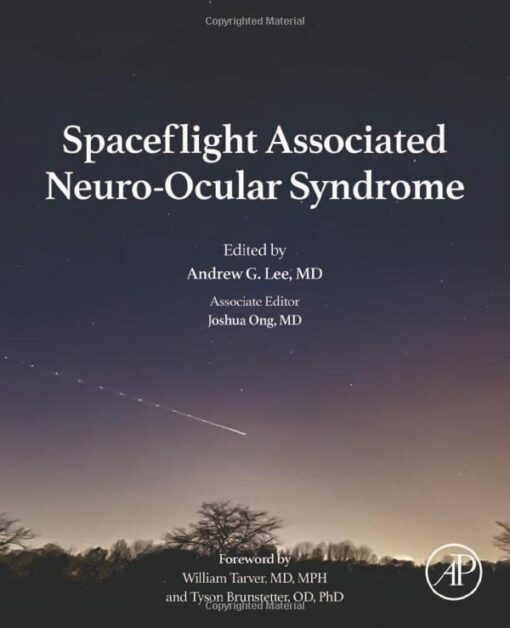 Spaceflight Associated Neuro-Ocular Syndrome (Original PDF from Publisher)