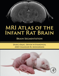 MRI Atlas of the Infant Rat Brain: Brain Segmentation (Original PDF from Publisher)