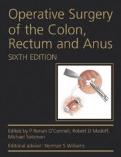Operative Surgery of the Colon, Rectum and Anus, 6th Edition (Original PDF)