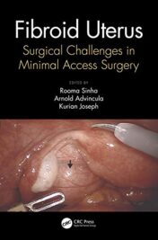 Fibroid Uterus: Surgical Challenges in Minimal Access Surgery (Original PDF)