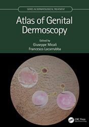 Atlas of Genital Dermoscopy Original PDF
