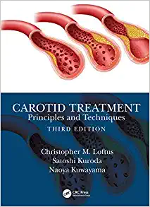 Carotid Treatment: Principles and Techniques, 3rd Edition (Original PDF from Publisher)