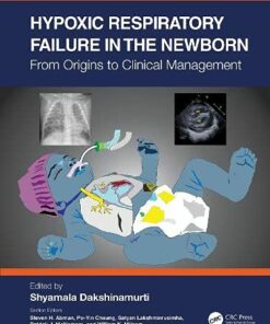 Hypoxic Respiratory Failure in the Newborn: From Origins to Clinical Management (Original PDF from Publisher)