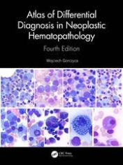 Atlas of Differential Diagnosis in Neoplastic Hematopathology 2021 Original pdf