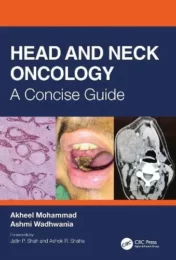 Head and Neck Oncology: A Concise Guide 2021 Original PDF