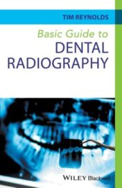 Basic Guide to Dental Radiography (Basic Guide Dentistry Series) (EPUB and CONVERTED PDF)