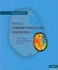 Toole’s Cerebrovascular Disorders, 6th Edition (Original PDF from Publisher)