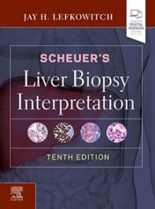 Scheuer’s Liver Biopsy Interpretation, 10th Edition (Original PDF)
