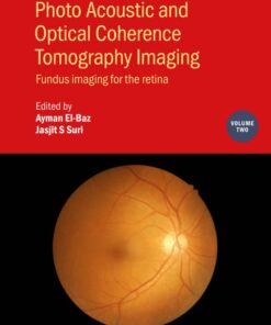 Photo Acoustic and Optical Coherence Tomography Imaging, Volume 2 (Original PDF from Publisher)