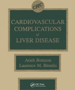Cardiovascular Complications of Liver Disease (Original PDF from Publisher)