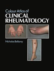 Colour Atlas of Clinical Rheumatology (Original PDF)