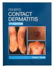 Fisher’s Contact Dermatitis, 7th Edition 2022 ePub+Converted PDF