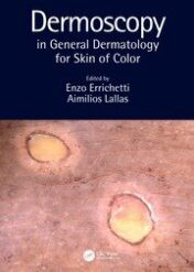 Dermoscopy in General Dermatology for Skin of Colour Original PDF 2021