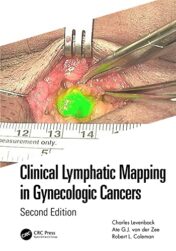 Clinical Lymphatic Mapping in Gynecologic Cancers, 2nd Edition 2022 Original PDF