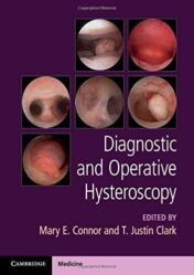 Diagnostic and Operative Hysteroscopy (ePub+Converted PDF)