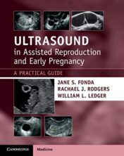 Ultrasound in Assisted Reproduction and Early Pregnancy: A Practical Guide (Original PDF)