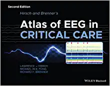Hirsch and Brenner’s Atlas of EEG in Critical Care, 2nd Edition (Original PDF from Publisher)