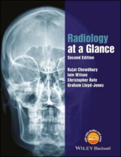 Radiology at a Glance, 2nd Edition (EPUB and CONVERTED PDF)