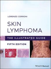 Skin Lymphoma: The Illustrated Guide, 5th Edition (Original PDF)