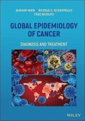 Global Epidemiology of Cancer: Diagnosis and Treatment 2022 Original PDF
