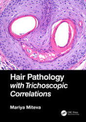 Hair Pathology with Trichoscopic Correlations 2021 Original pdf