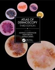 Atlas of Dermoscopy: Third Edition 2022 Original PDF