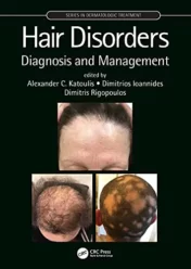 Hair Disorders: Diagnosis and Management (Series in Dermatological Treatment) 1st Ed 2021 Original pdf