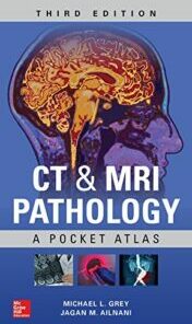 CT & MRI Pathology: A Pocket Atlas, Third Edition (ORIGINAL PDF)