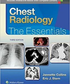 Chest Radiology: The Essentials, 3rd Edition (Original PDF from Publisher)