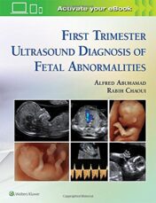 First Trimester Ultrasound Diagnosis of Fetal Abnormalities (EPUB and CONVERTED PDF)