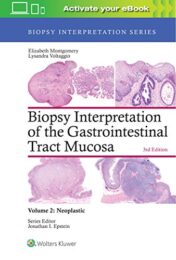 Biopsy Interpretation of the Gastrointestinal Tract Mucosa: Volume 2: Neoplastic (Biopsy Interpretation Series), 3rd Edition (EPUB+PDF)