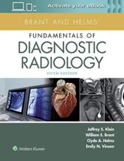 Brant and Helms’ Fundamentals of Diagnostic Radiology, 5th Edition (High Quality Scanned PDF)
