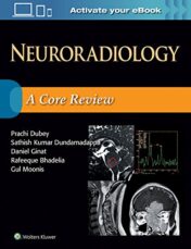 Neuroradiology: A Core Review (Epub and CONVERTED PDF)