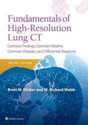 Fundamentals of High-Resolution Lung CT: Common Findings, Common Patterns, Common Diseases and Differential Diagnosis, 2ed (ePUB  and CONVERTED PDF)