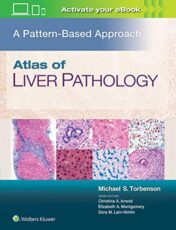 Atlas of Liver Pathology: A Pattern-Based Approach (ePub+Converted PDF)