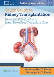 Quick Guide to Kidney Transplantation (EPUB + Converted PDF)