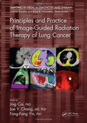 Principles and Practice of Image-Guided Radiation Therapy of Lung Cancer (PDF)