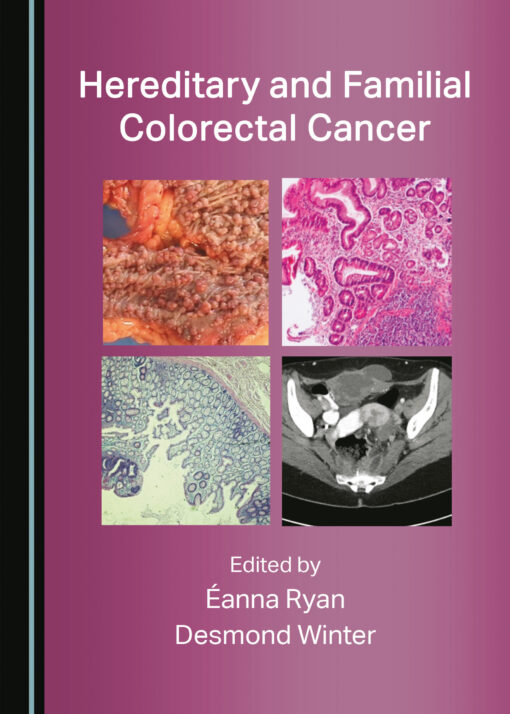 Hereditary and Familial Colorectal Cancer (Original PDF from Publisher)