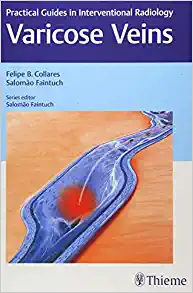 Varicose Veins: Practical Guides in Interventional Radiology, 1st edition (EPUB)