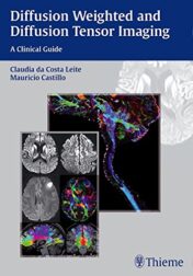 Diffusion Weighted and Diffusion Tensor Imaging: A Clinical Guide (ORIGINAL PDF)