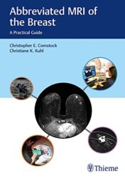 Abbreviated MRI of the Breast: A Practical Guide (EPUB and CONVERTED PDF)