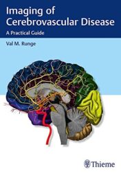 Imaging of Cerebrovascular Disease: A Practical Guide (ORIGINAL PDF)