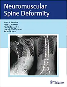 Neuromuscular Spine Deformity, 1st edition (EPUB)
