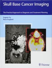 Skull Base Cancer Imaging: The Practical Approach to Diagnosis and Treatment Planning (Original PDF)