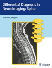 Differential Diagnosis in Neuroimaging: Spine (PDF)
