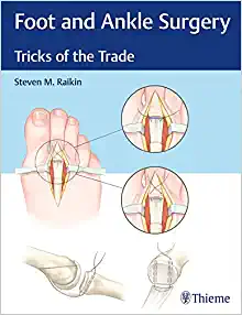 Foot and Ankle Surgery: Tricks of the Trade (EPUB)