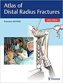 Atlas of Distal Radius Fractures, 1st edition (EPUB)