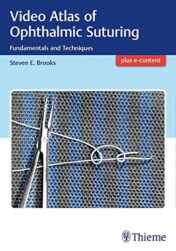 Video Atlas of Ophthalmic Suturing: Fundamentals and Techniques (PDF)